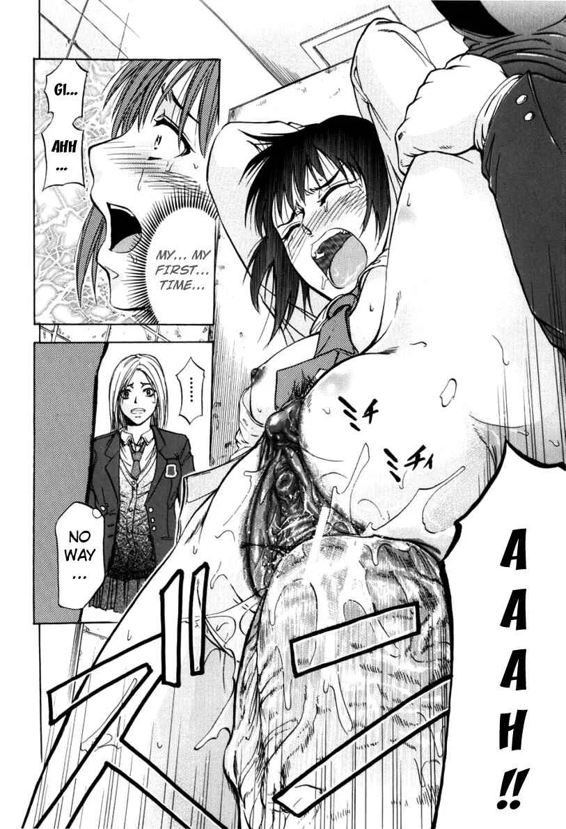 Anal Backer Chapter 1: Hemerroid Shock - Page 26