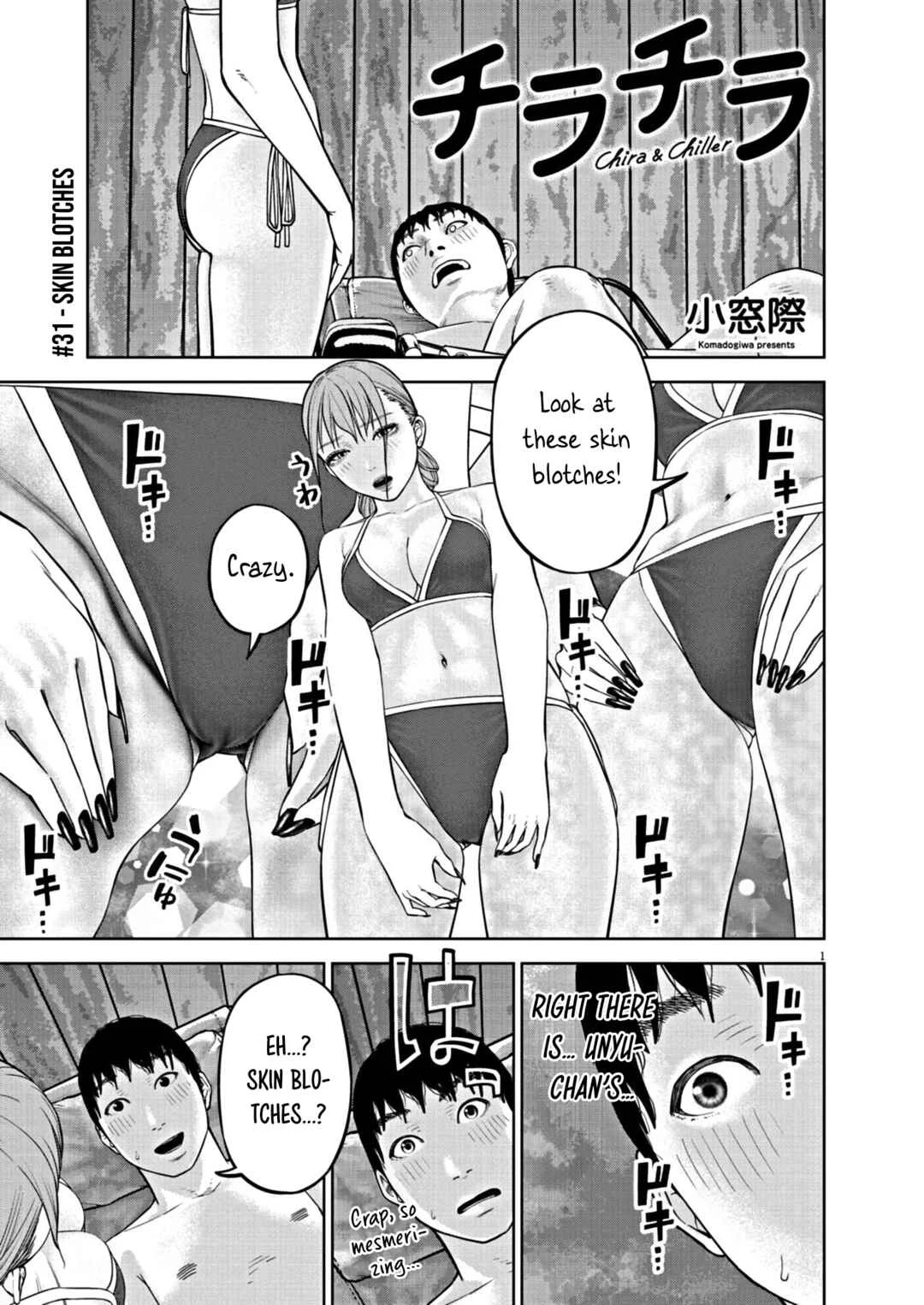 Chira Chiller Chapter 31: Skin Blotches - Page 1