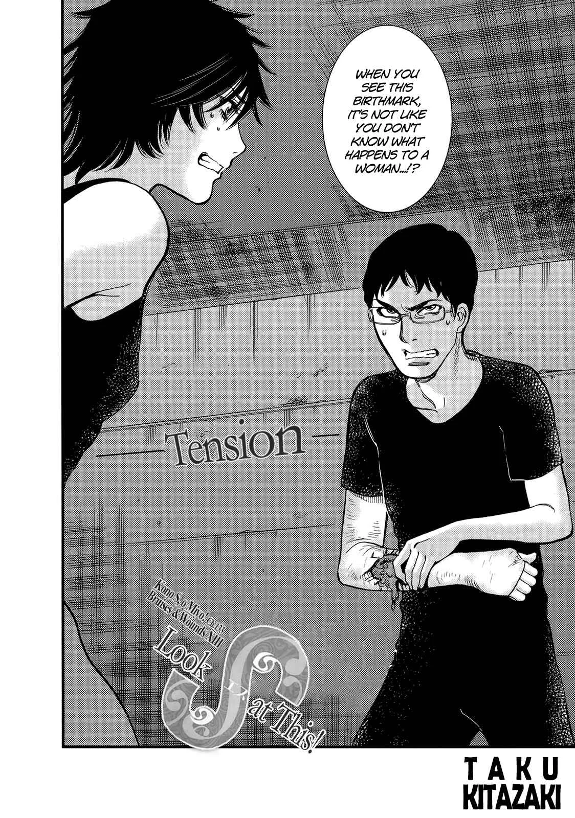 Kono S wo, Mi yo! - Cupid no Itazura Chapter 133: Bruises and Wounds XIII - Page 2
